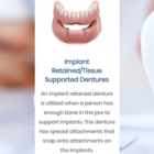 Don Mills Denture Clinic - Denturists