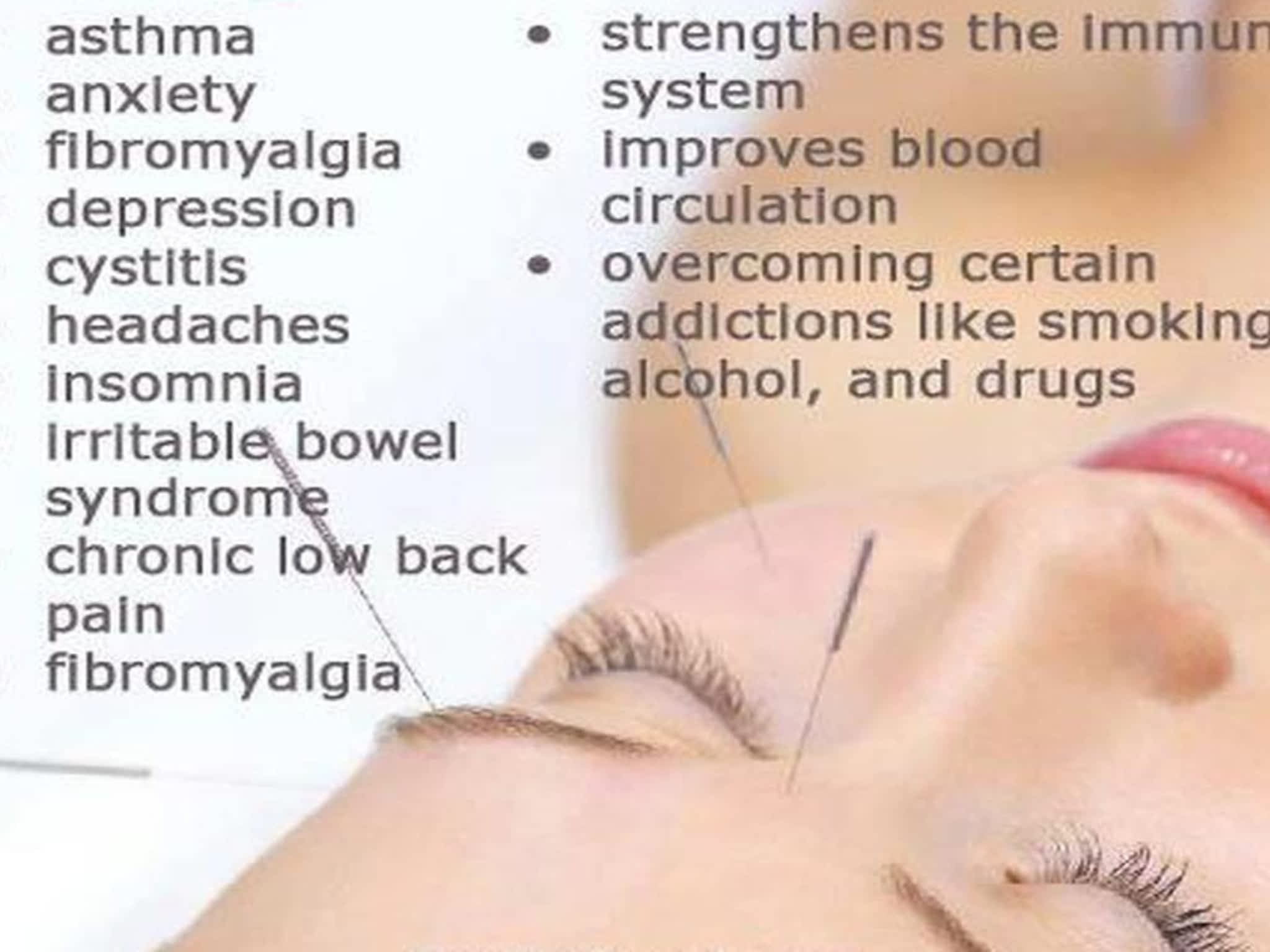 photo Sun's Acupuncture & Wellness Centre