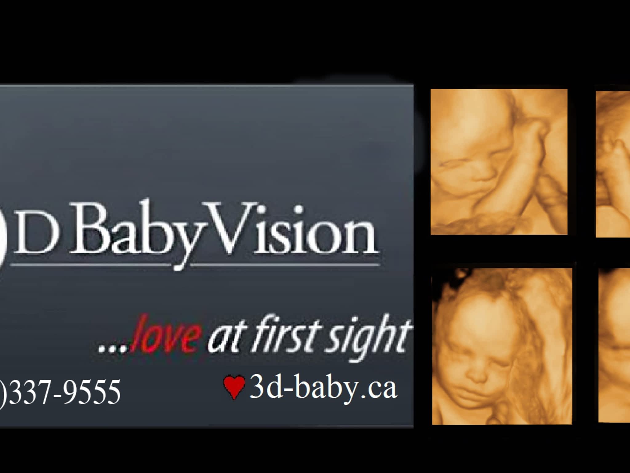 photo Baby Vision 3D Ultrasound