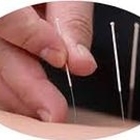 Acupuncture Chinoise à Montréal - ZhiFang(Lily) Zhai - Holistic Health Care