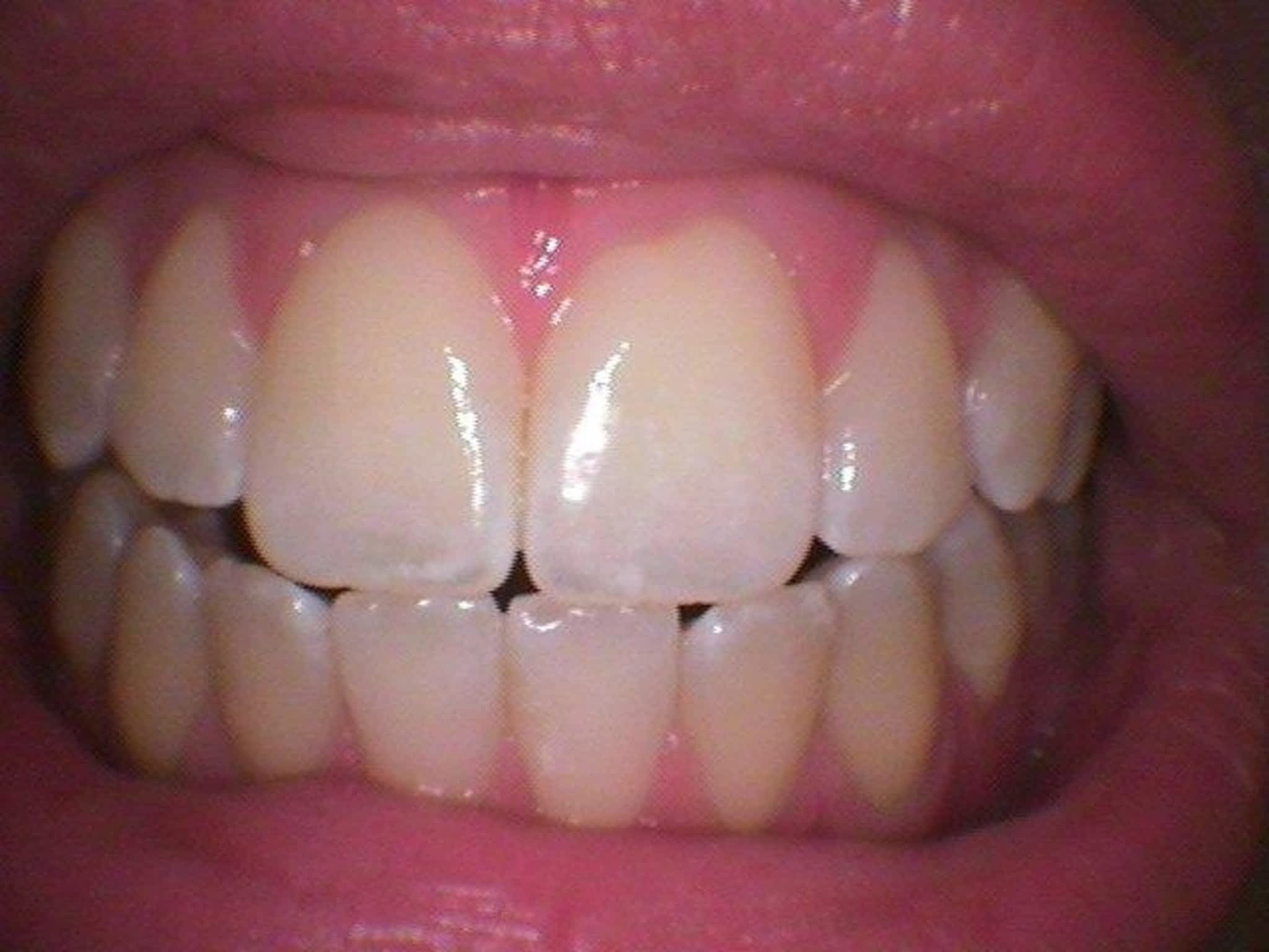 photo Robyn Kempe O A Dental