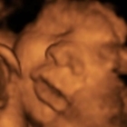 Blooming Baby Images - Medical & Dental X-Ray Laboratories