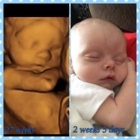 My Forever Blessing 3D/4D Ultrasound - Reproduction photographique