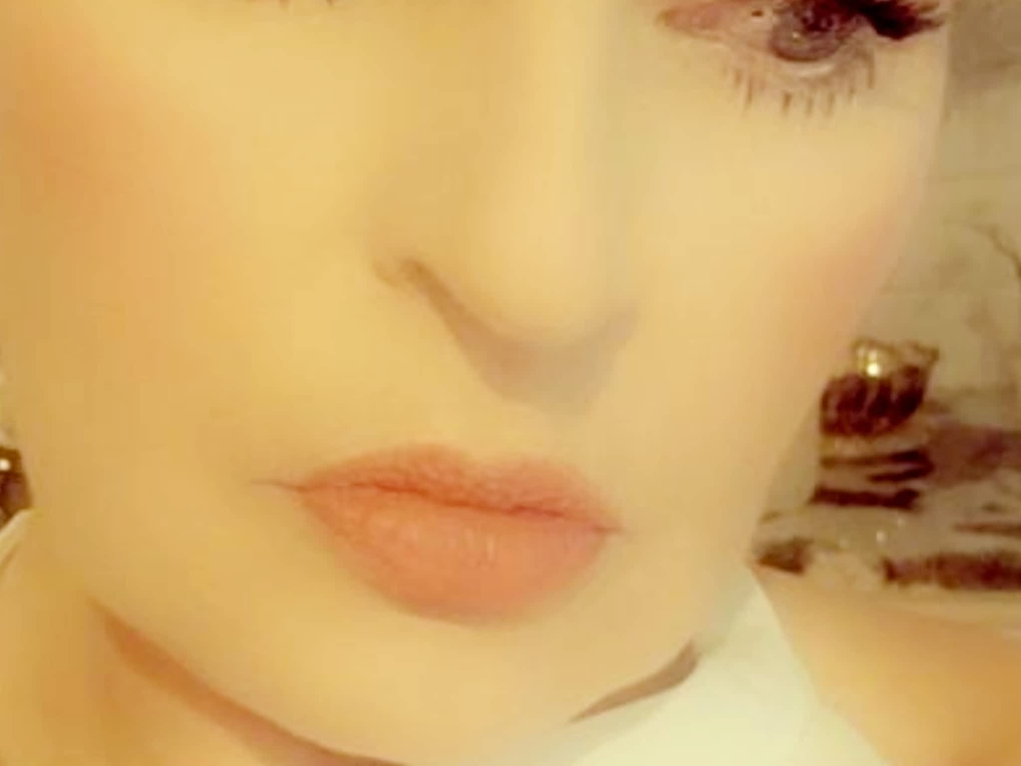 photo Caress Aesthetic