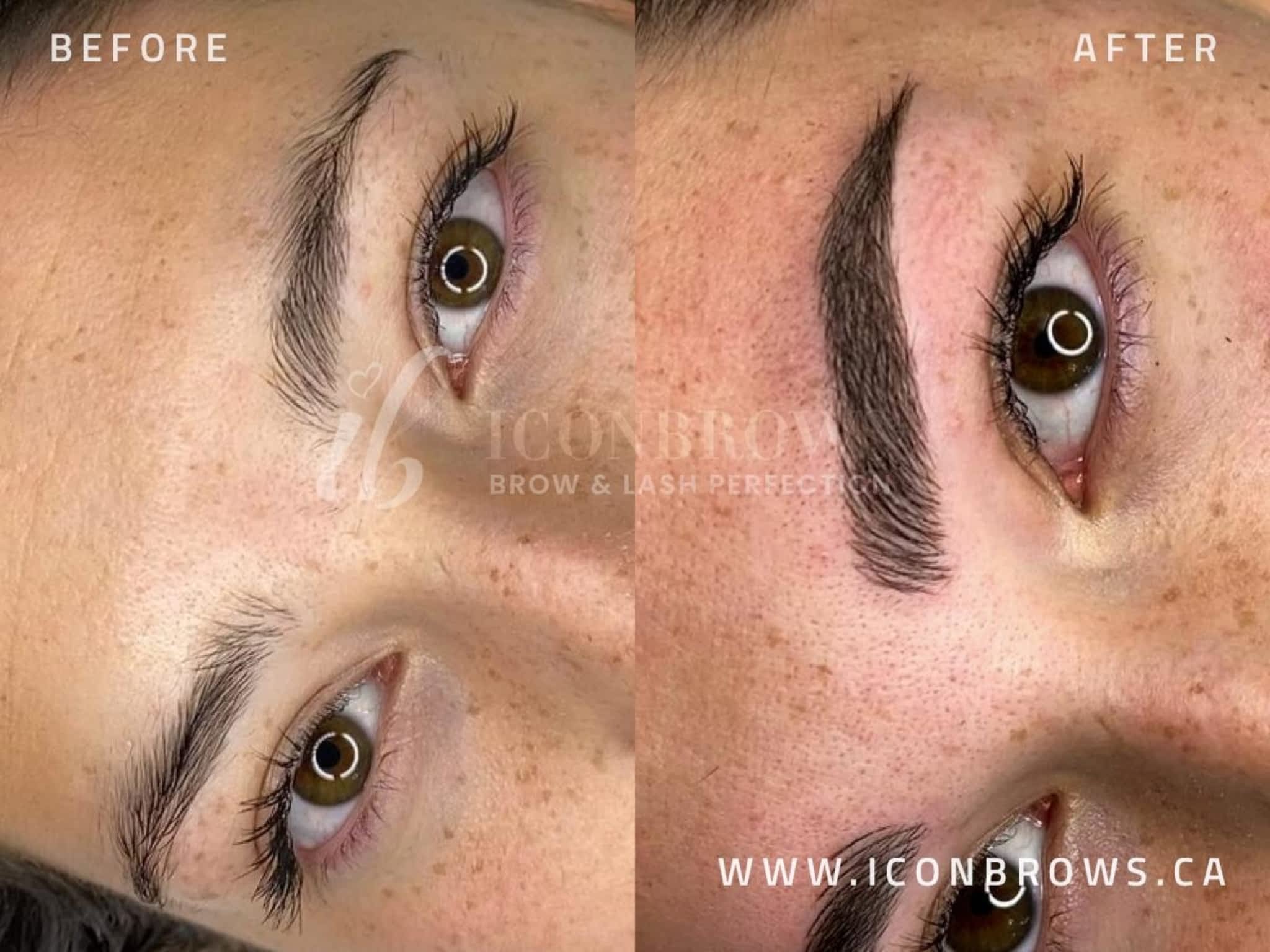 photo Iconbrows - Eyebrow Perfection | Professional Microblading