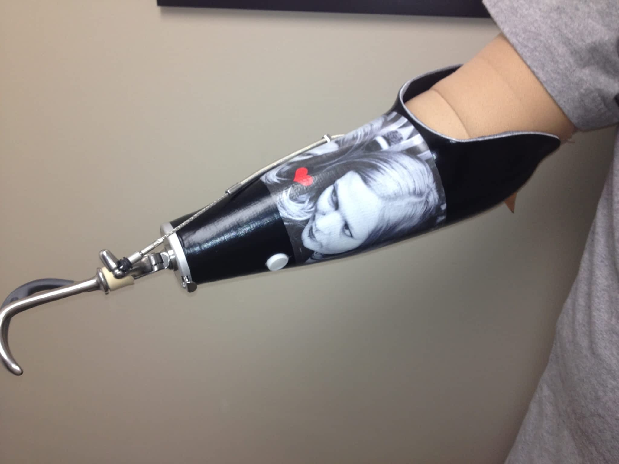 photo Action Orthotics & Prosthetics