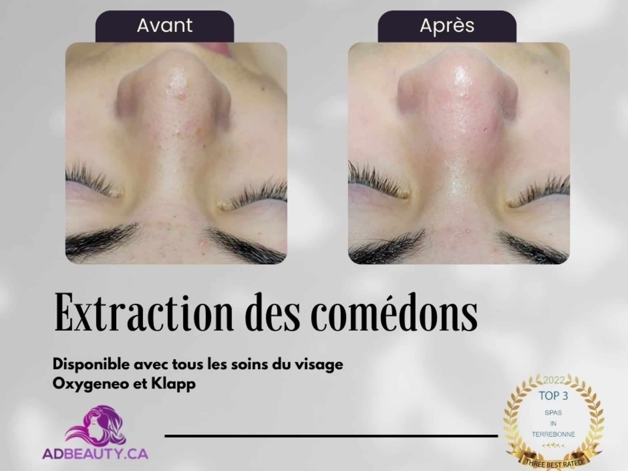 photo ADBeauty.ca Esthétique - Dermo-Esthéticienne Spécialiste en soin visage