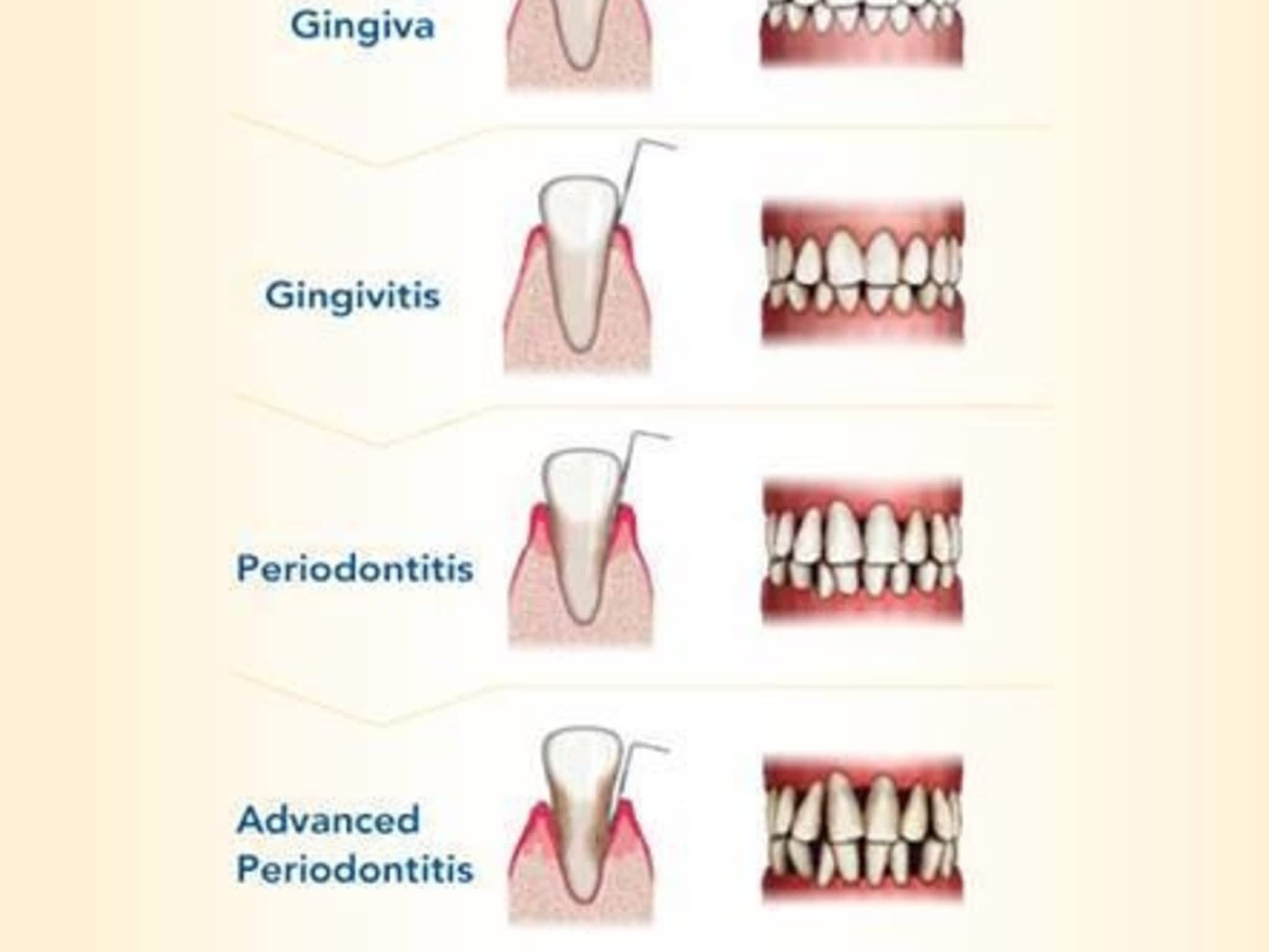 Sierra Springs Dental Airdrie Airdrie, AB 2821 Main St SW Canpages