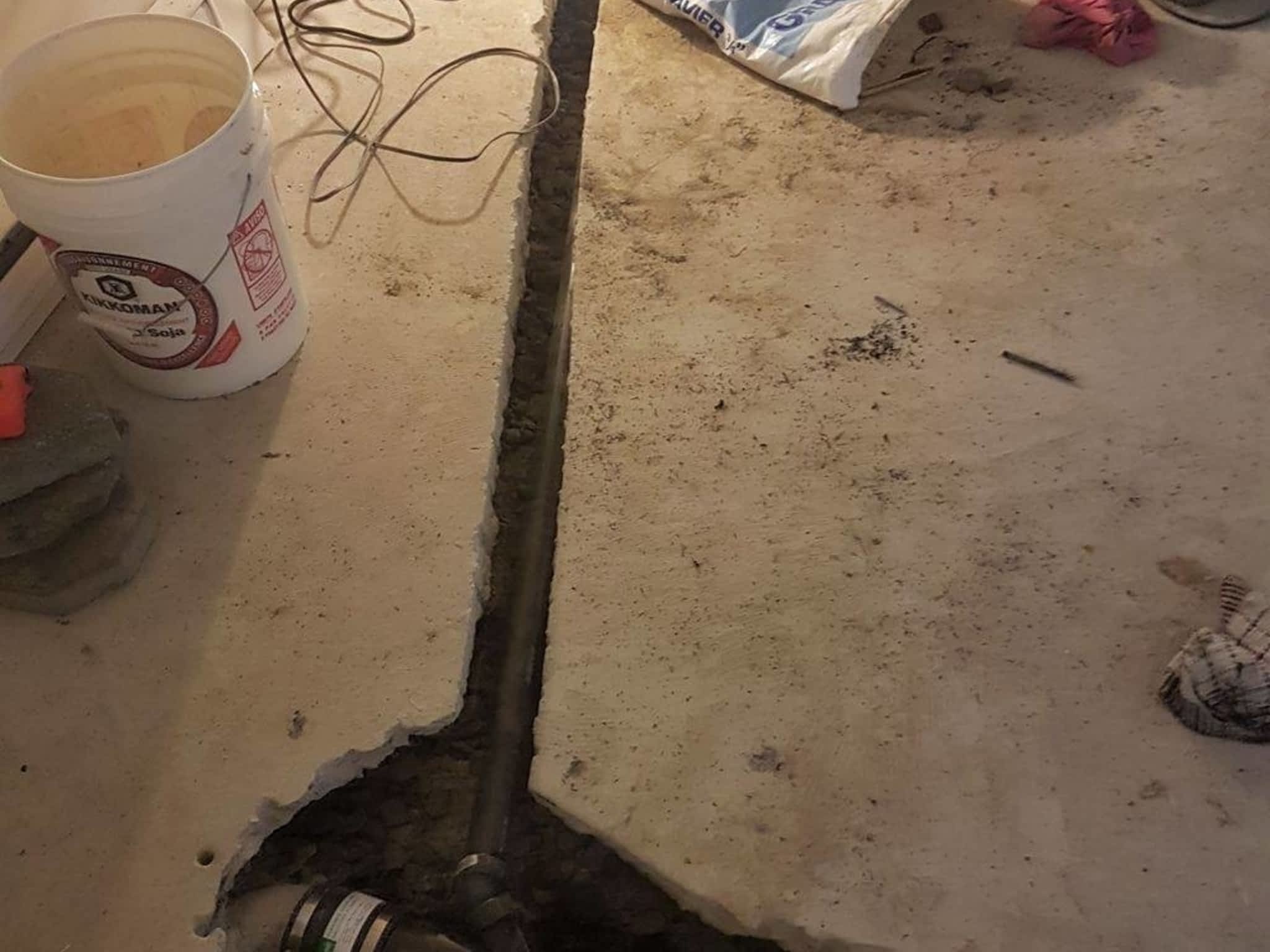 photo Fissures & Drains HDL