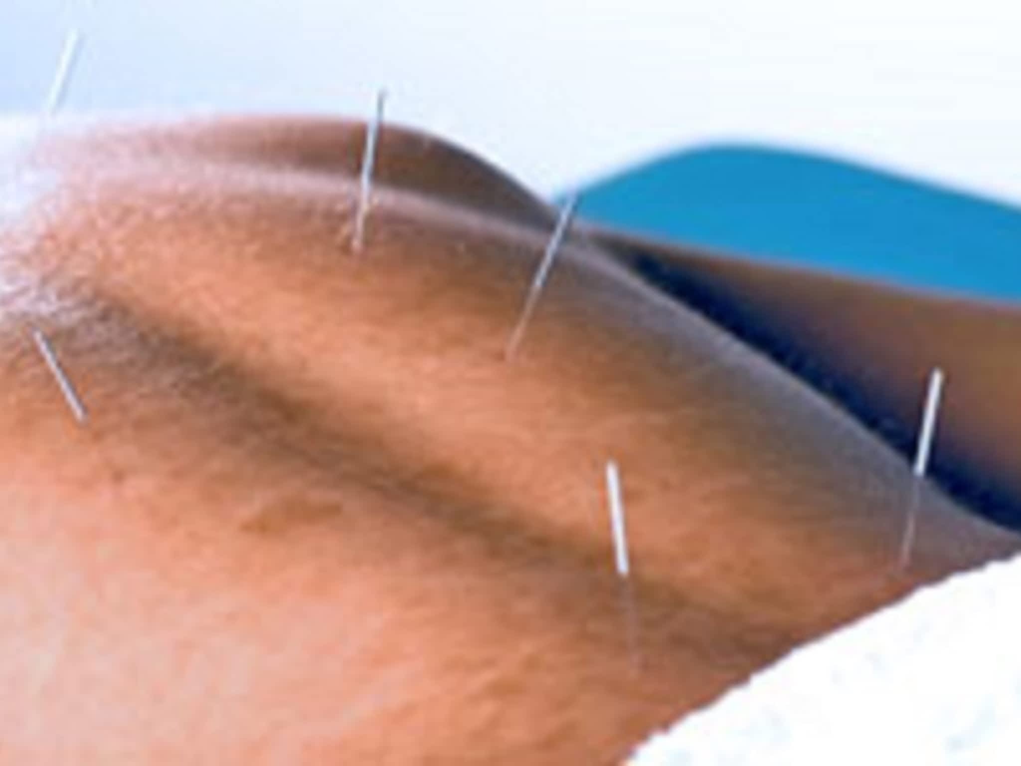 photo Acupuncture & Acupressure Clinic