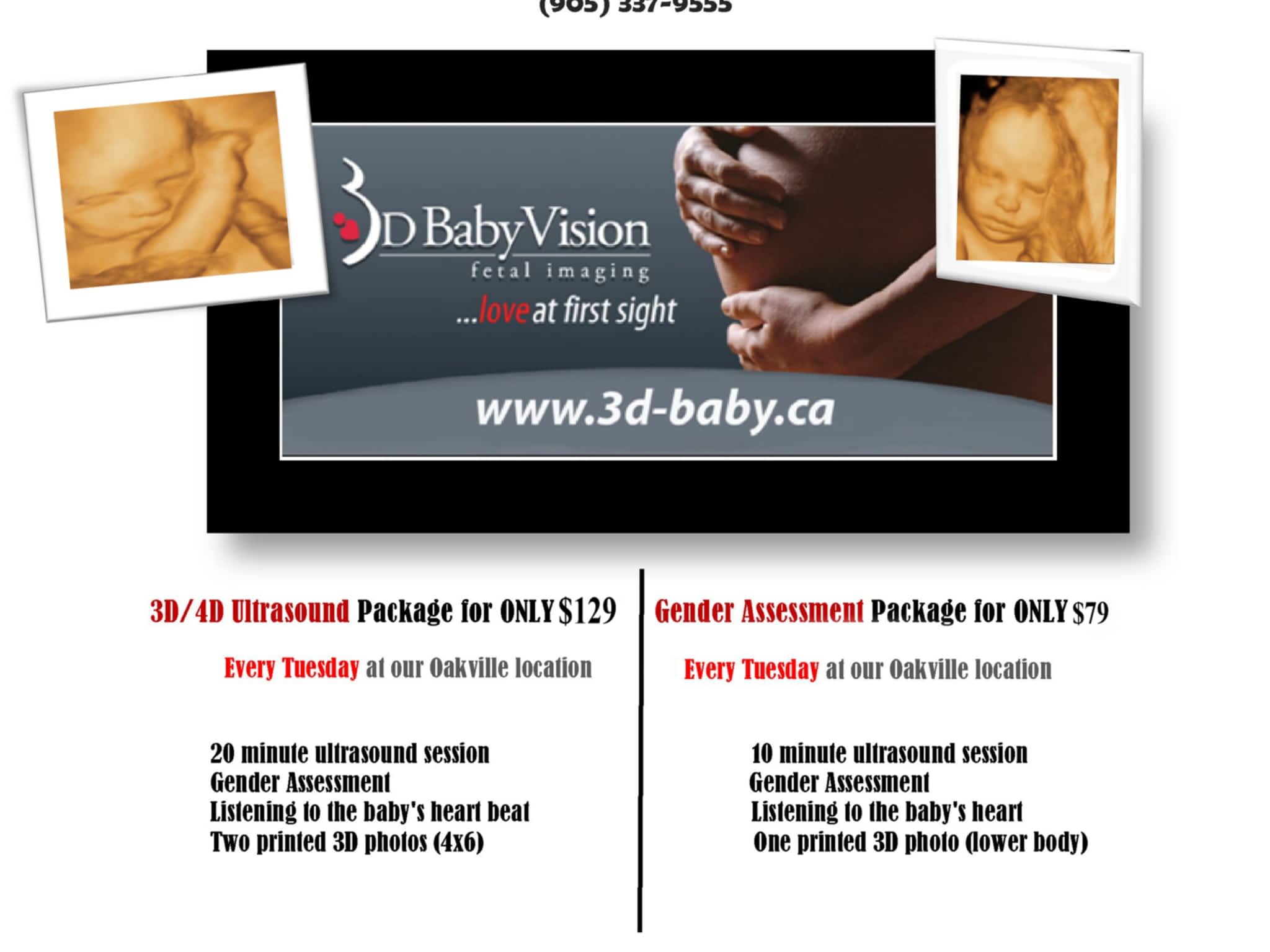 photo Baby Vision 3D Ultrasound