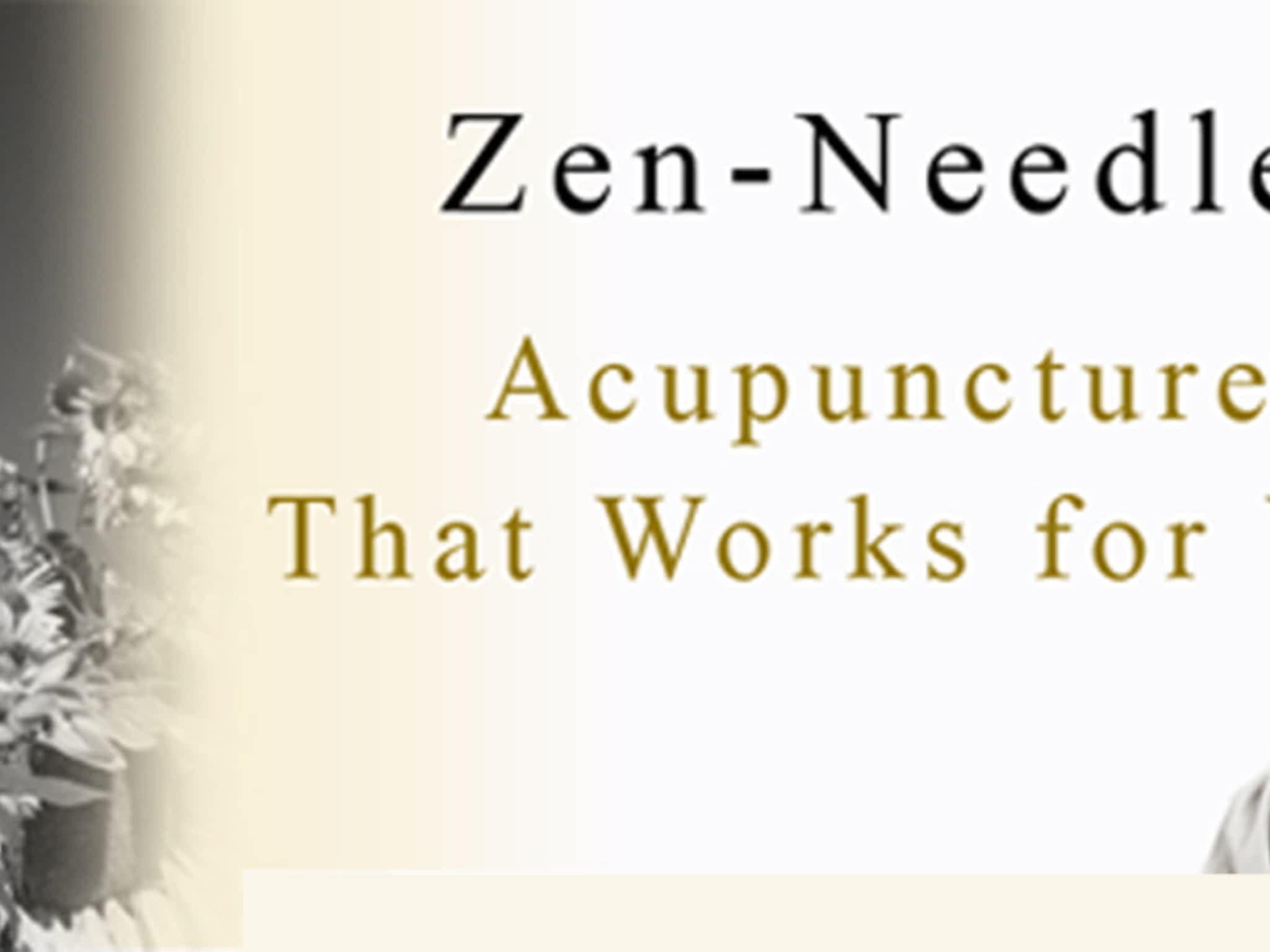 photo Zen Needle Acupuncture