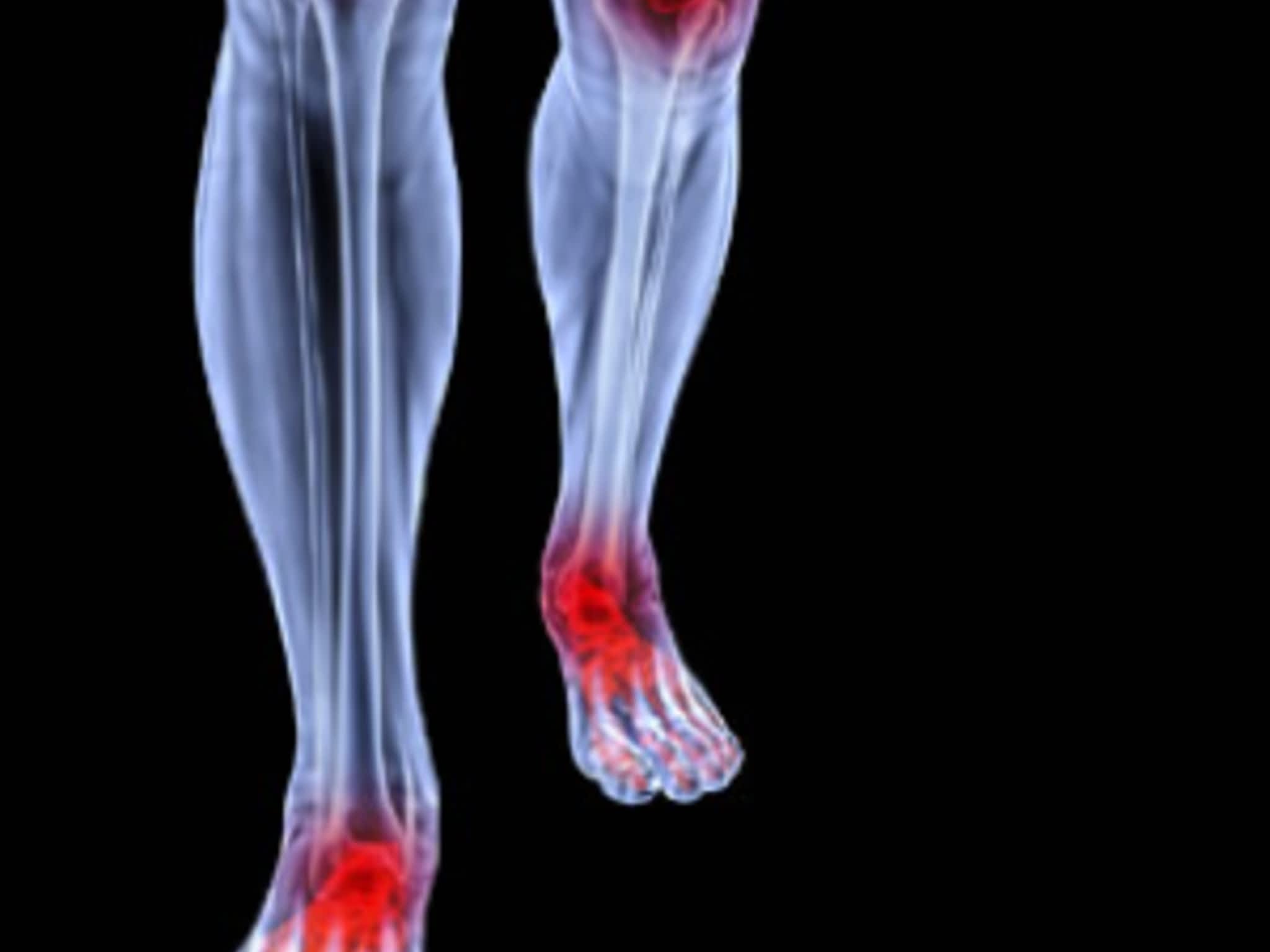 photo Rite Step Orthotics