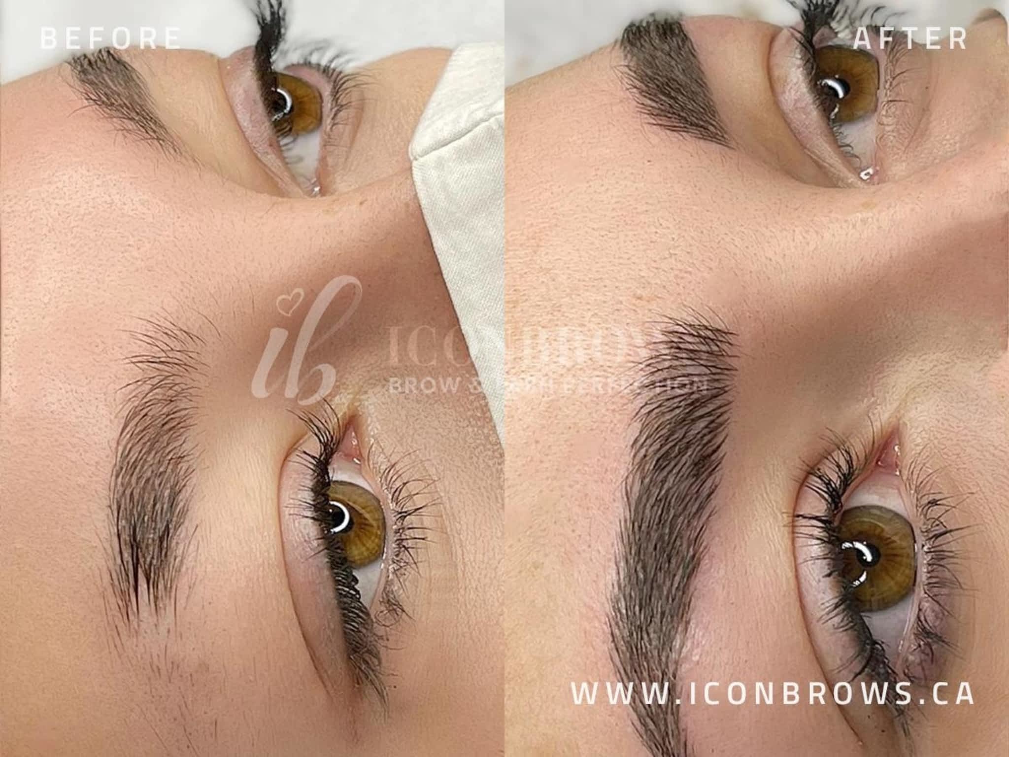 photo Iconbrows - Eyebrow Perfection | Professional Microblading