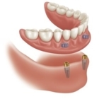 Eden Denture Clinic - Traitement de blanchiment des dents