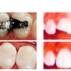 Centre Dentaire Saint-Georges Inc - Teeth Whitening Services