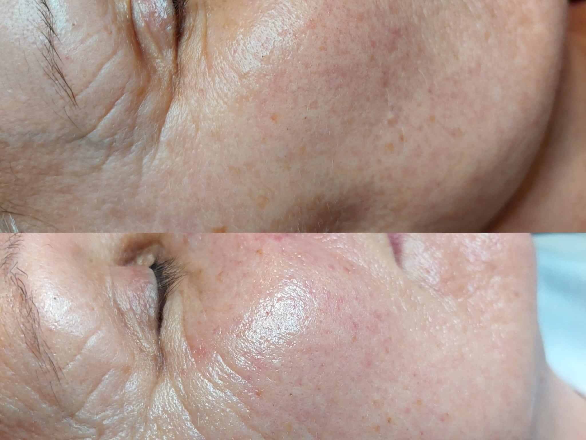 photo Clinique Beauté Médic - Soin du visage, Épilation laser Lévis