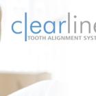 Brockville Family Dentistry - Traitement de blanchiment des dents