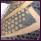 Les Chasseurs d'Encre - Détatouage laser