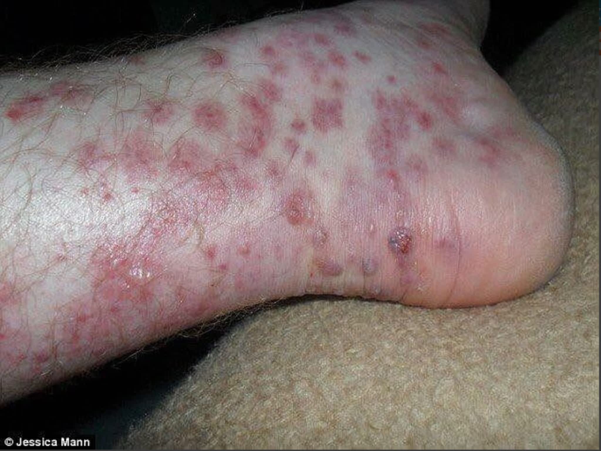 photo HotThor Construction