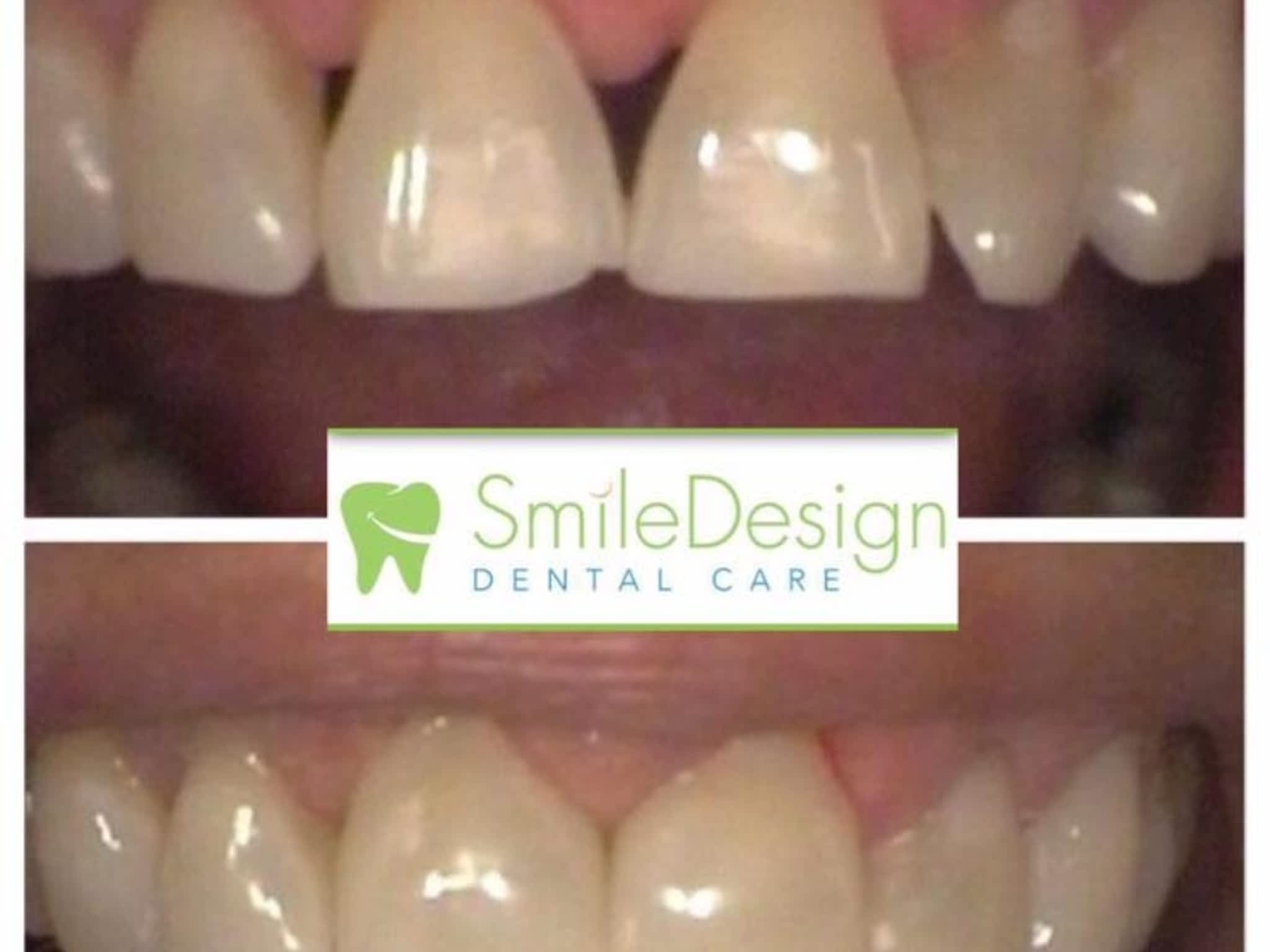 photo Smile Design Dental Care