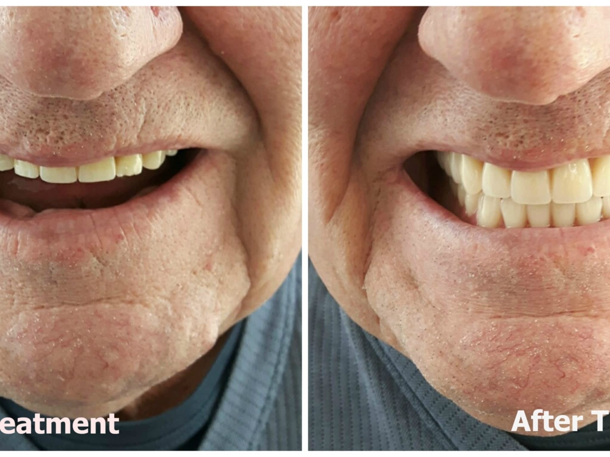 Kelowna Denture Clinic Kelowna, BC 1021824 Gordon Dr Canpages