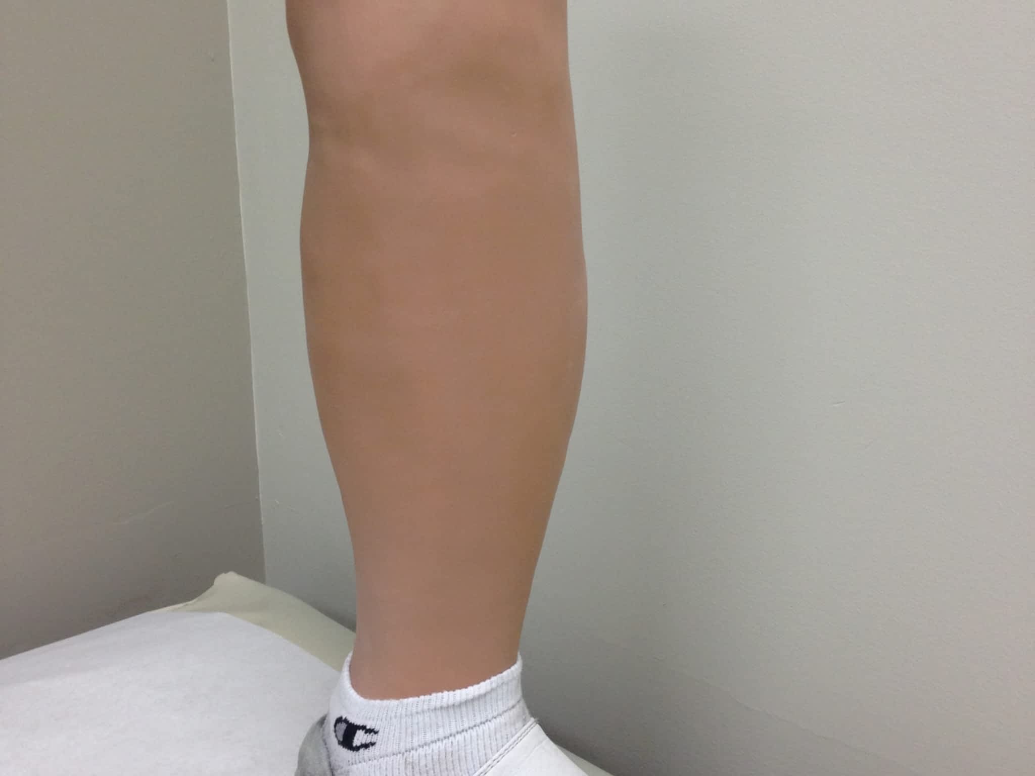 photo Action Orthotics & Prosthetics