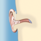 Le Réseau Vos Oreilles - Prothèses auditives