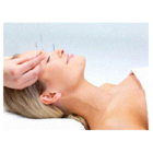 Wing Chee Acupuncture & Skin Care - Acupuncteurs