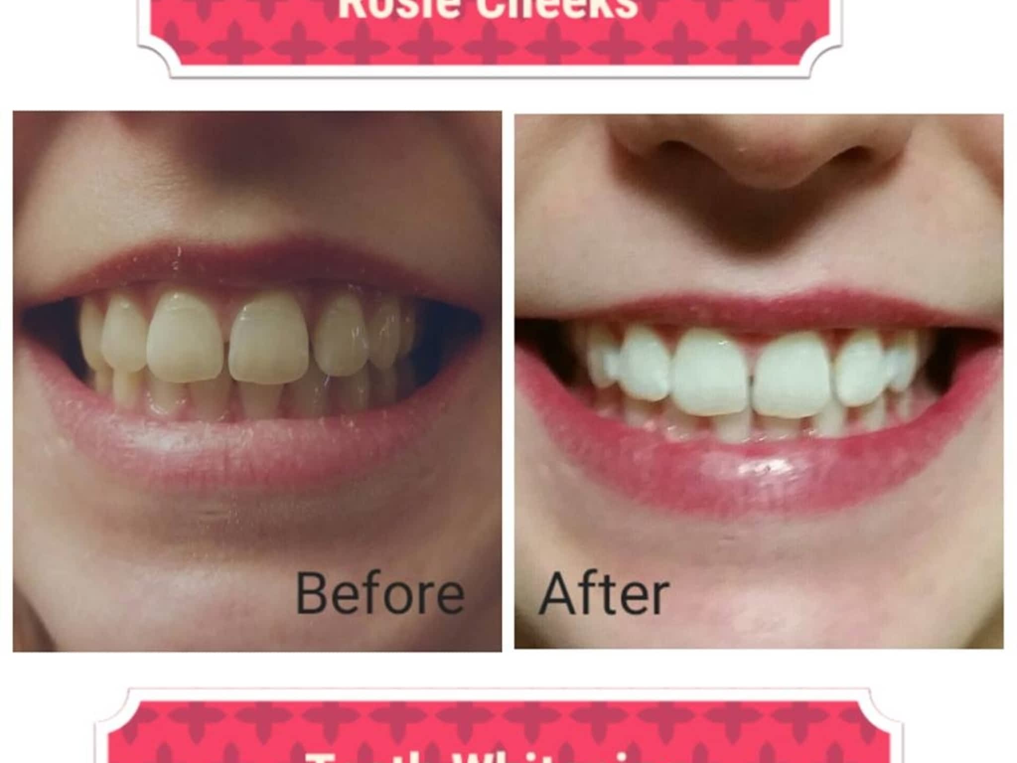 photo Rosie Cheeks Mobile Spray Tanning & Teeth Whitening