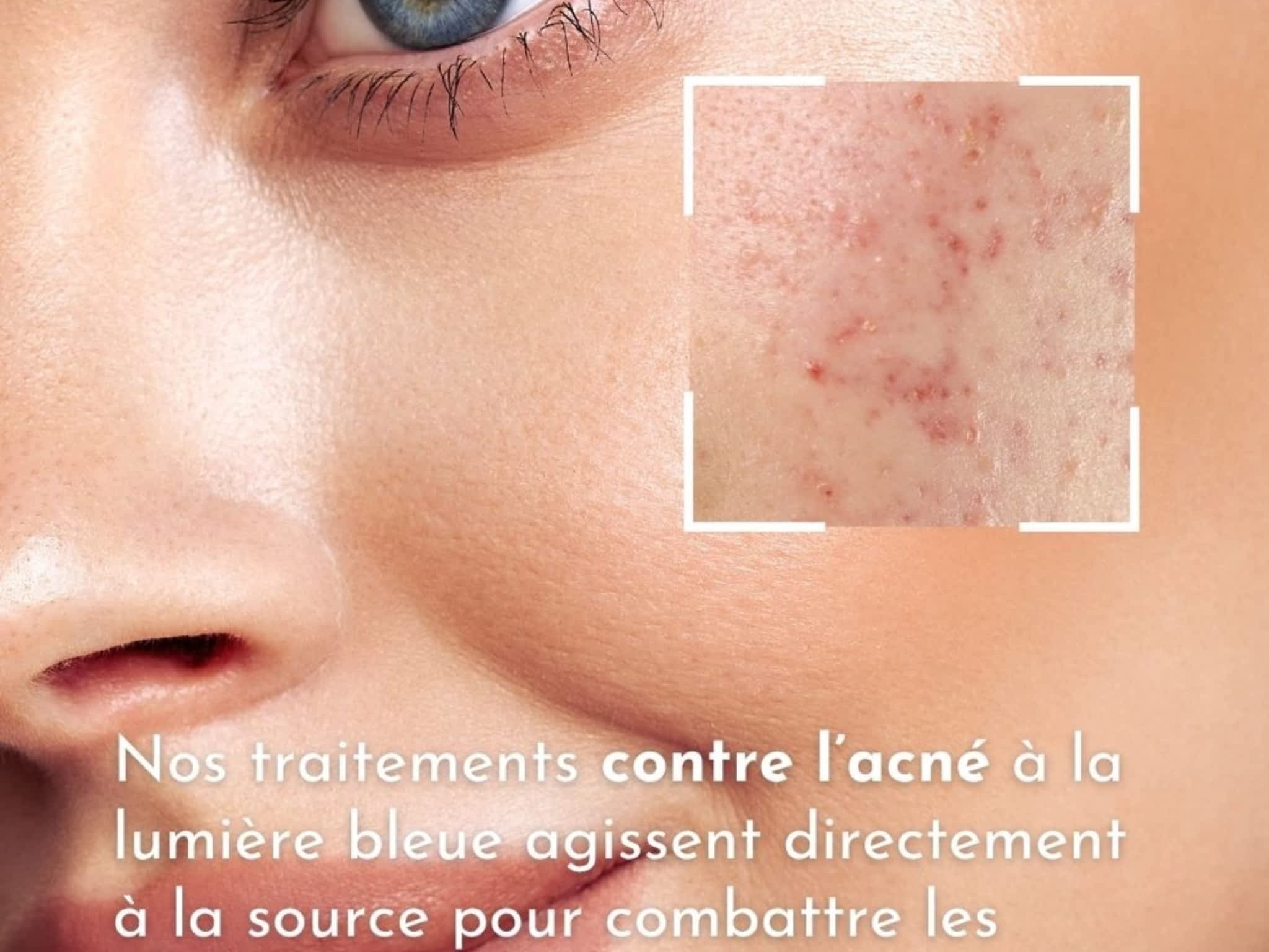 photo BRAVA Esthetic