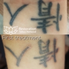 Gogi Korean BBQ - Détatouage laser