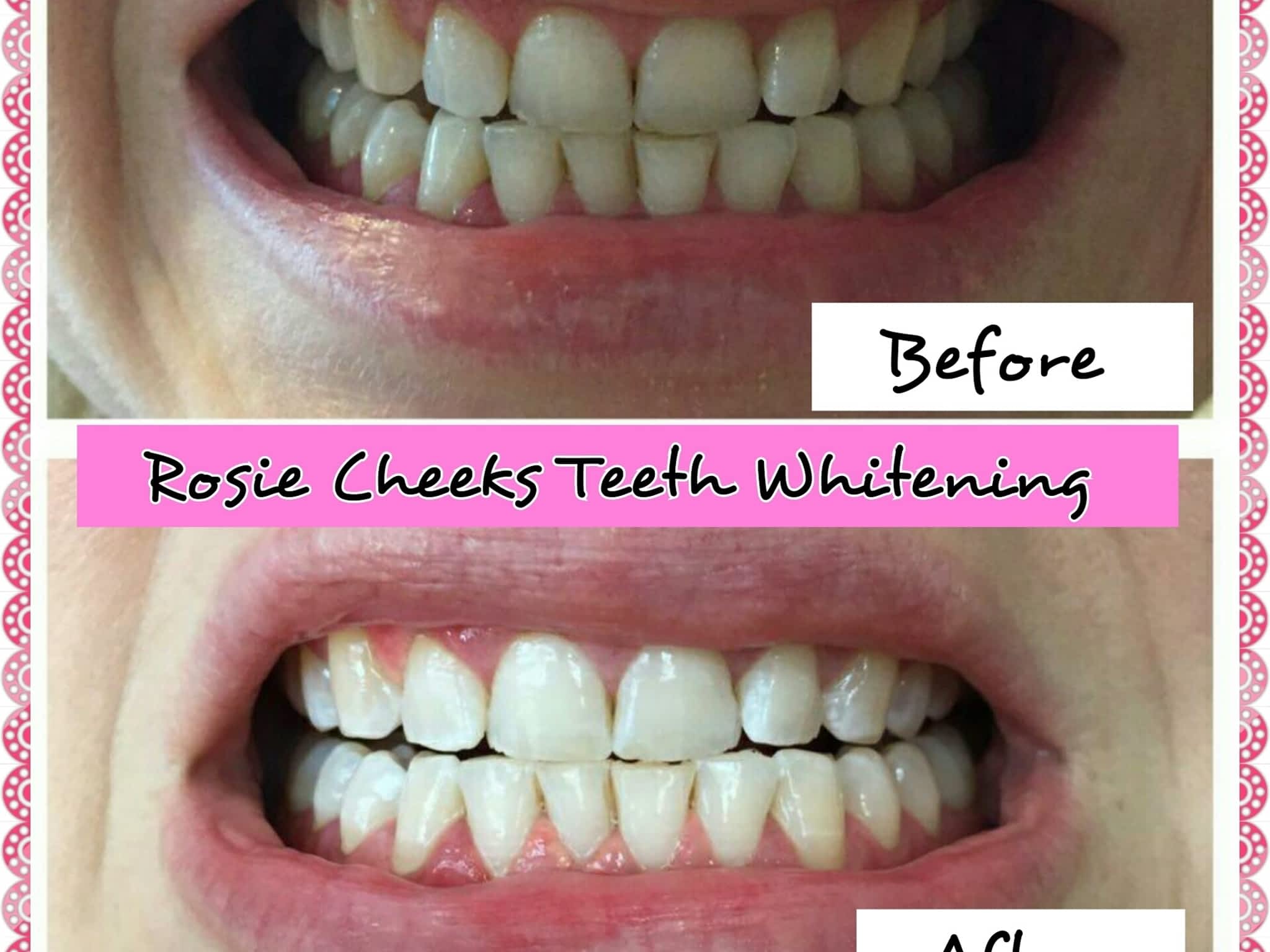 photo Rosie Cheeks Mobile Spray Tanning & Teeth Whitening