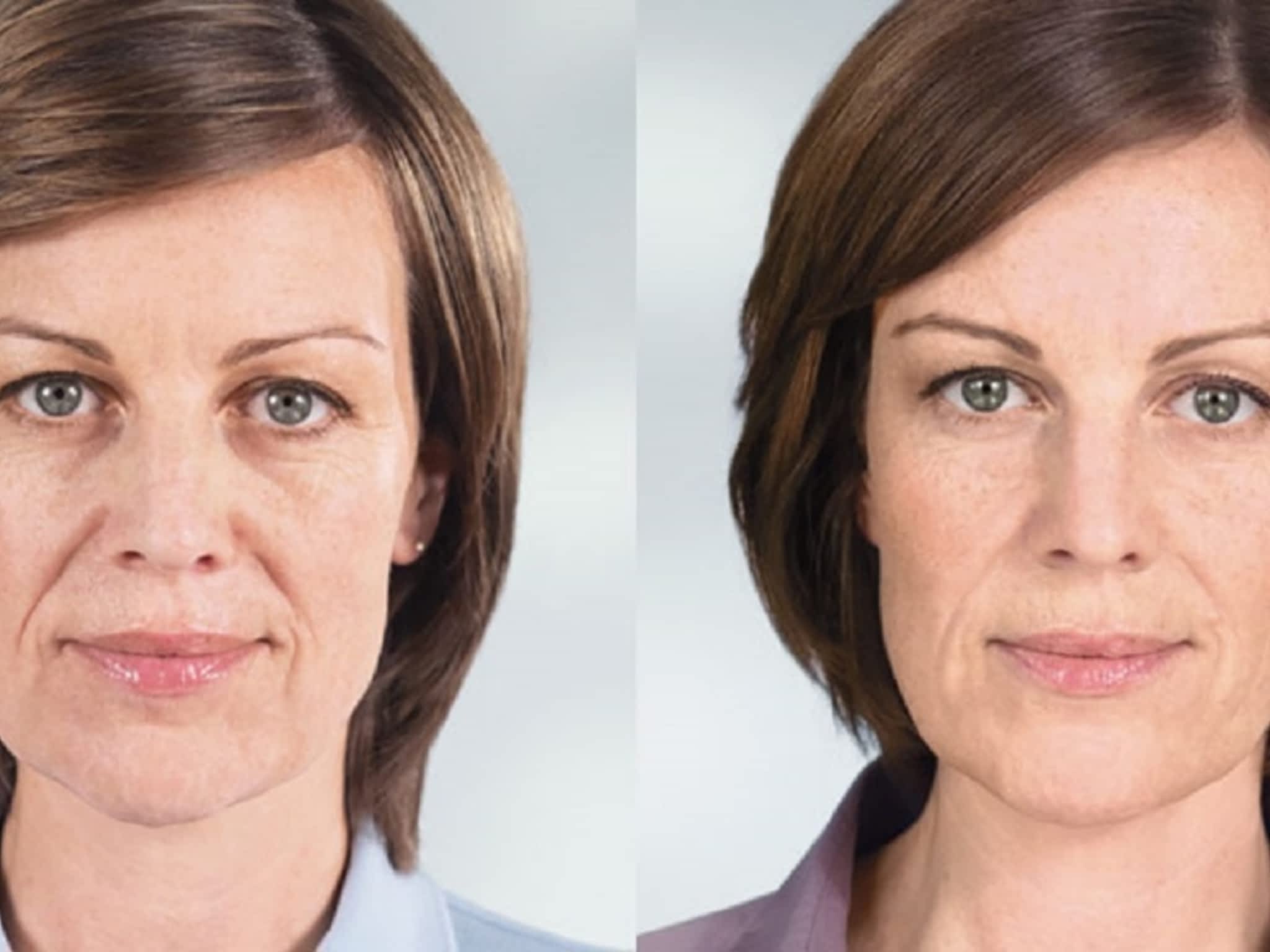 photo Dermapure Canmore