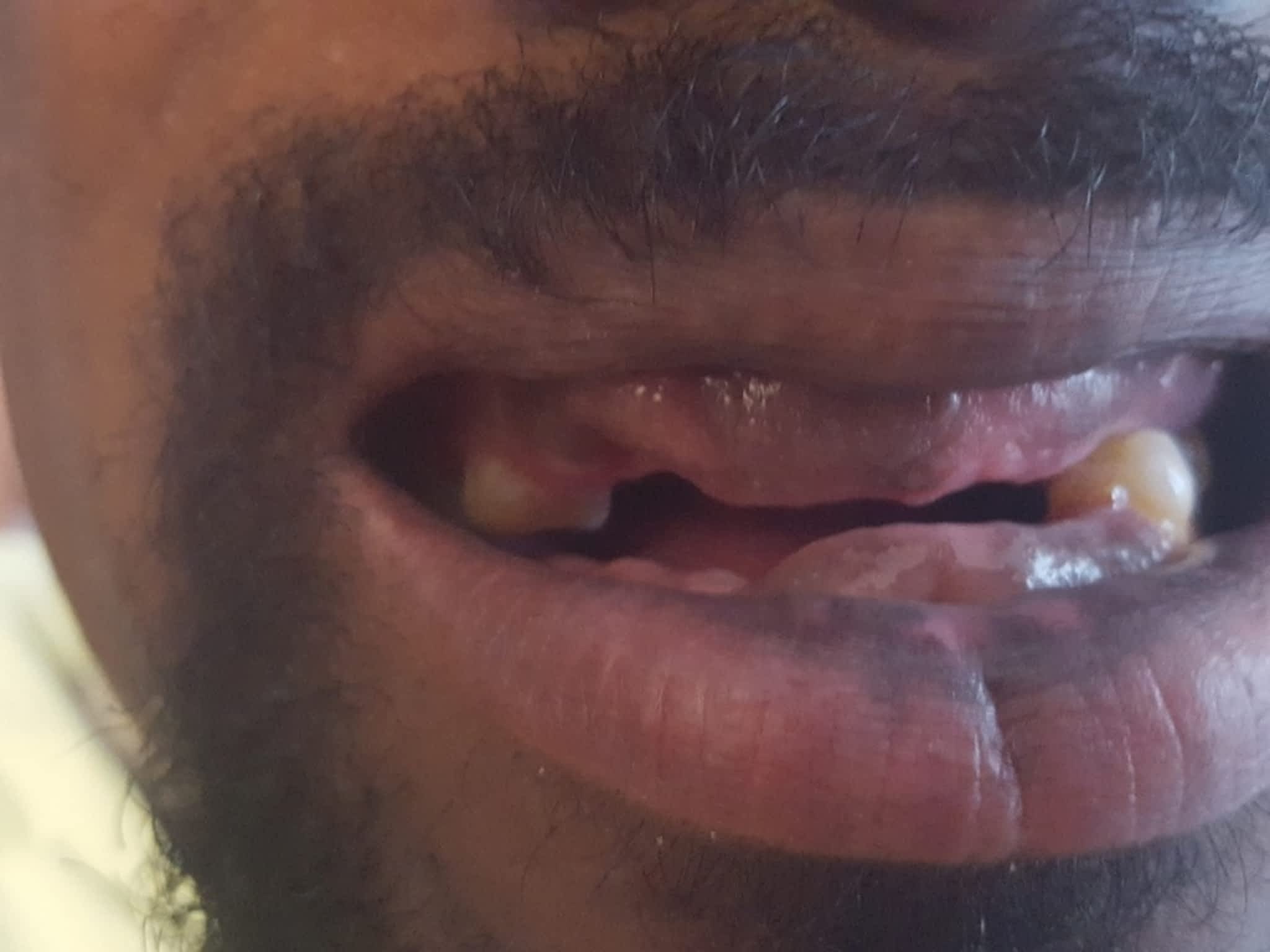 photo Mobile Denture Services