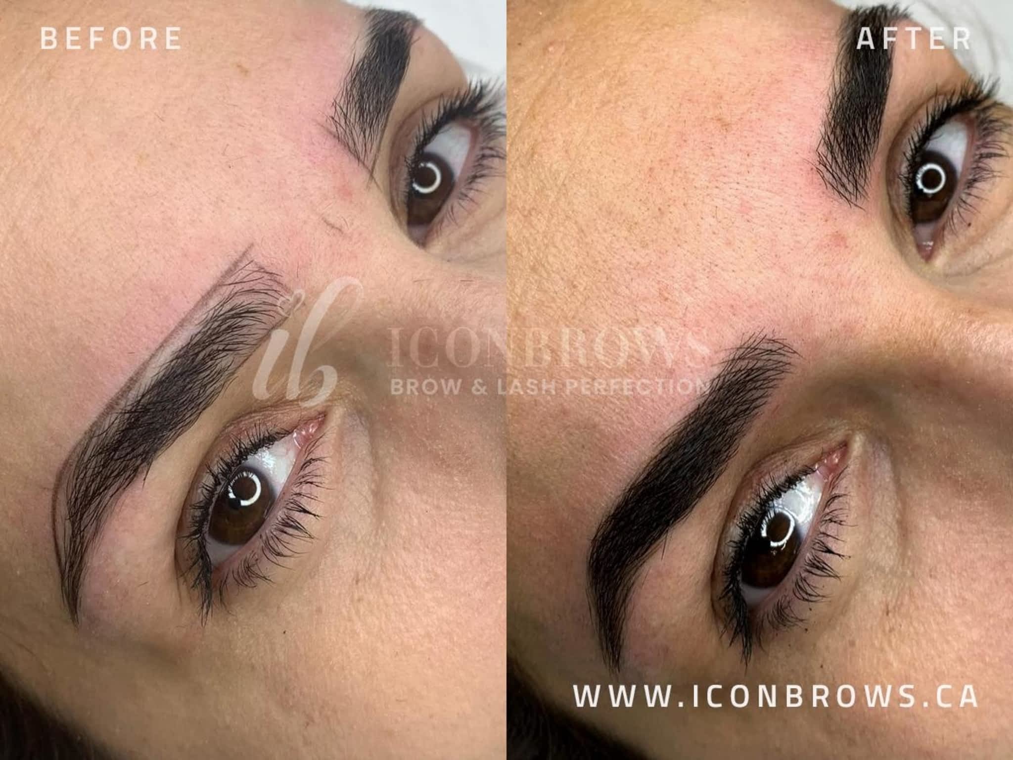 photo Iconbrows - Eyebrow Perfection | Professional Microblading