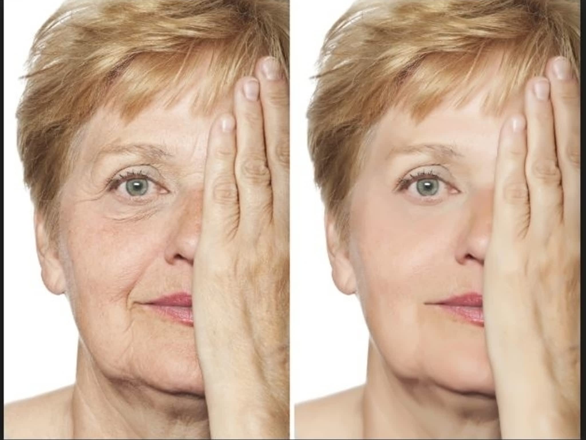 photo Dermapure Canmore