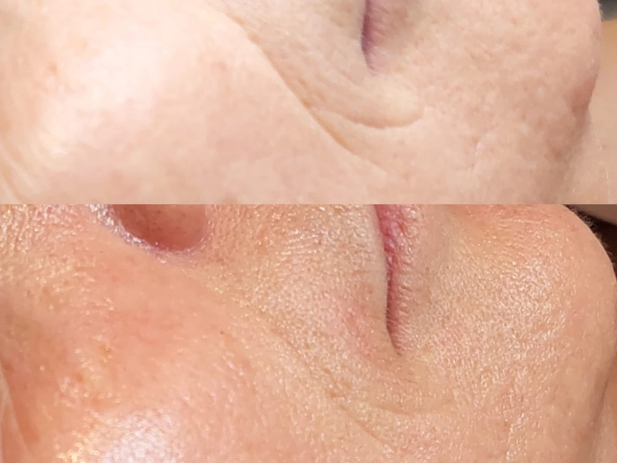 photo Clinique Beauté Médic - Soin du visage, Épilation laser Lévis