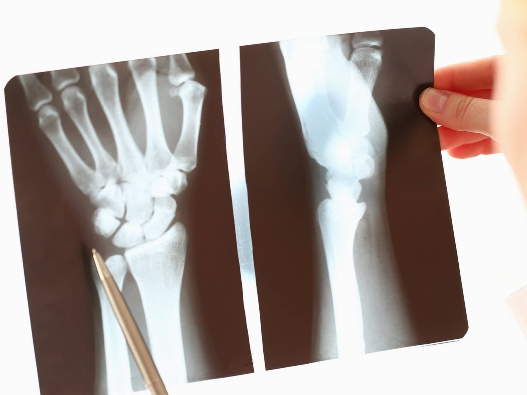 photo Physio Élite - Physiothérapeute Saint-Jérôme