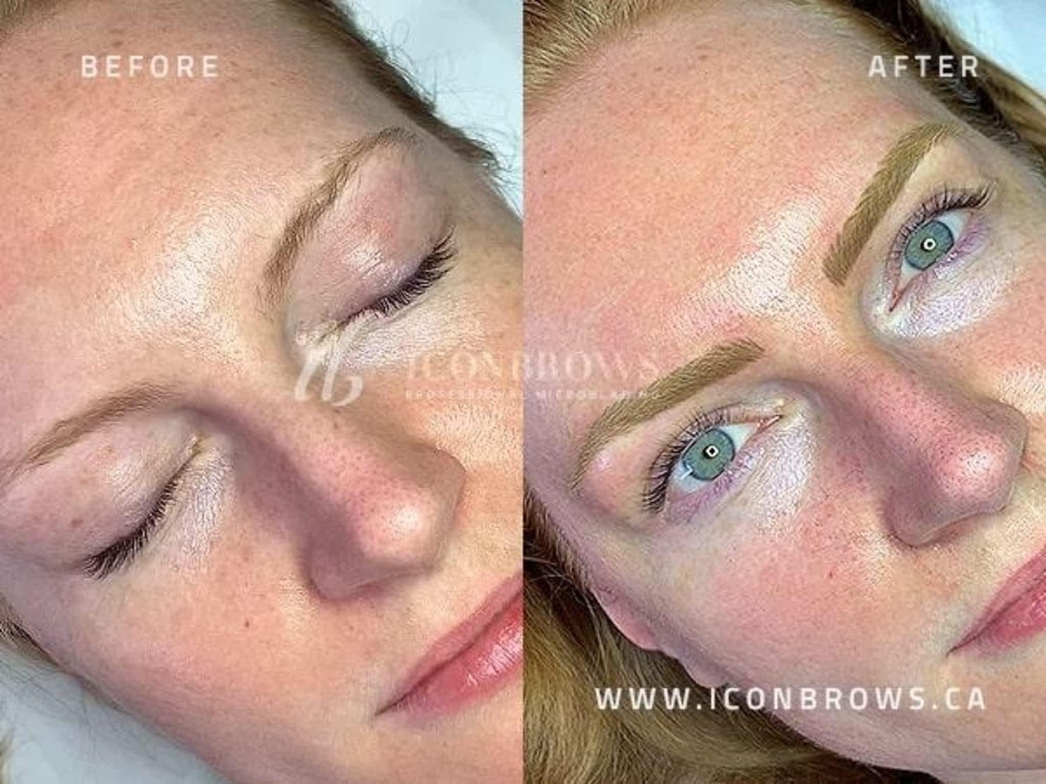 photo Iconbrows - Eyebrow Perfection | Professional Microblading