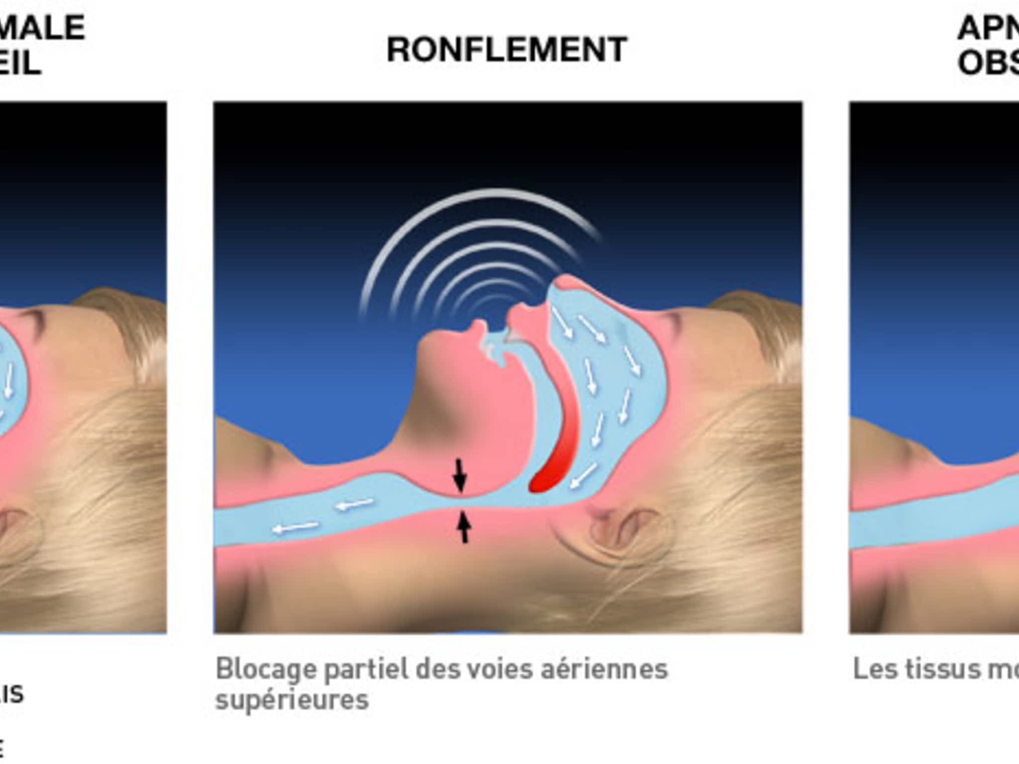 photo Apnée du sommeil Montréal, La Boite à CPAP