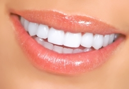 Where to whiten and brighten your smile in Vancouver
