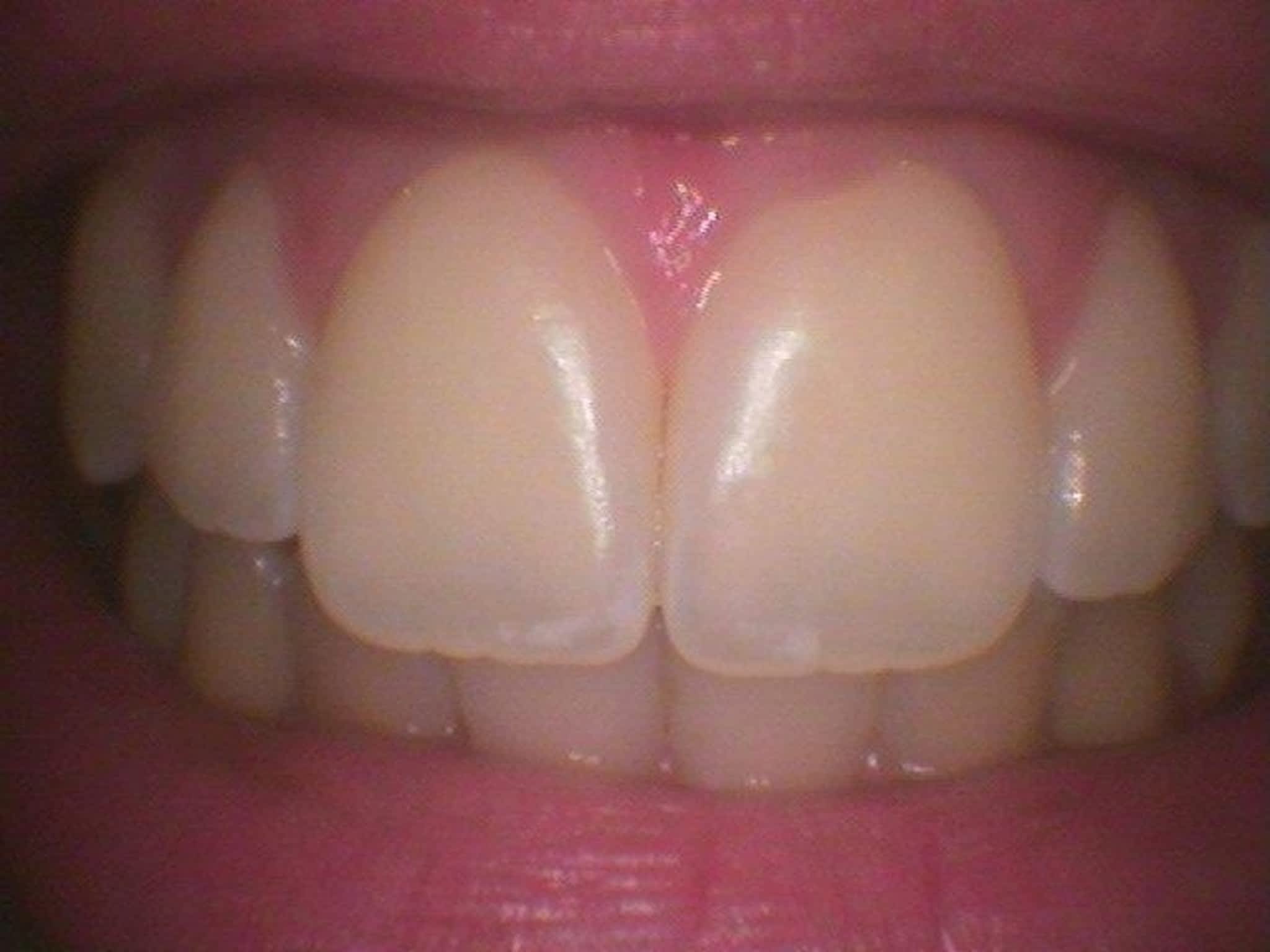 photo Robyn Kempe O A Dental