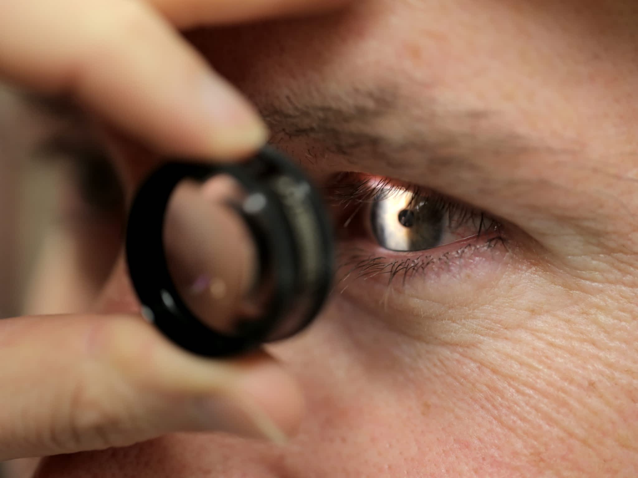 photo Summit Eyecare