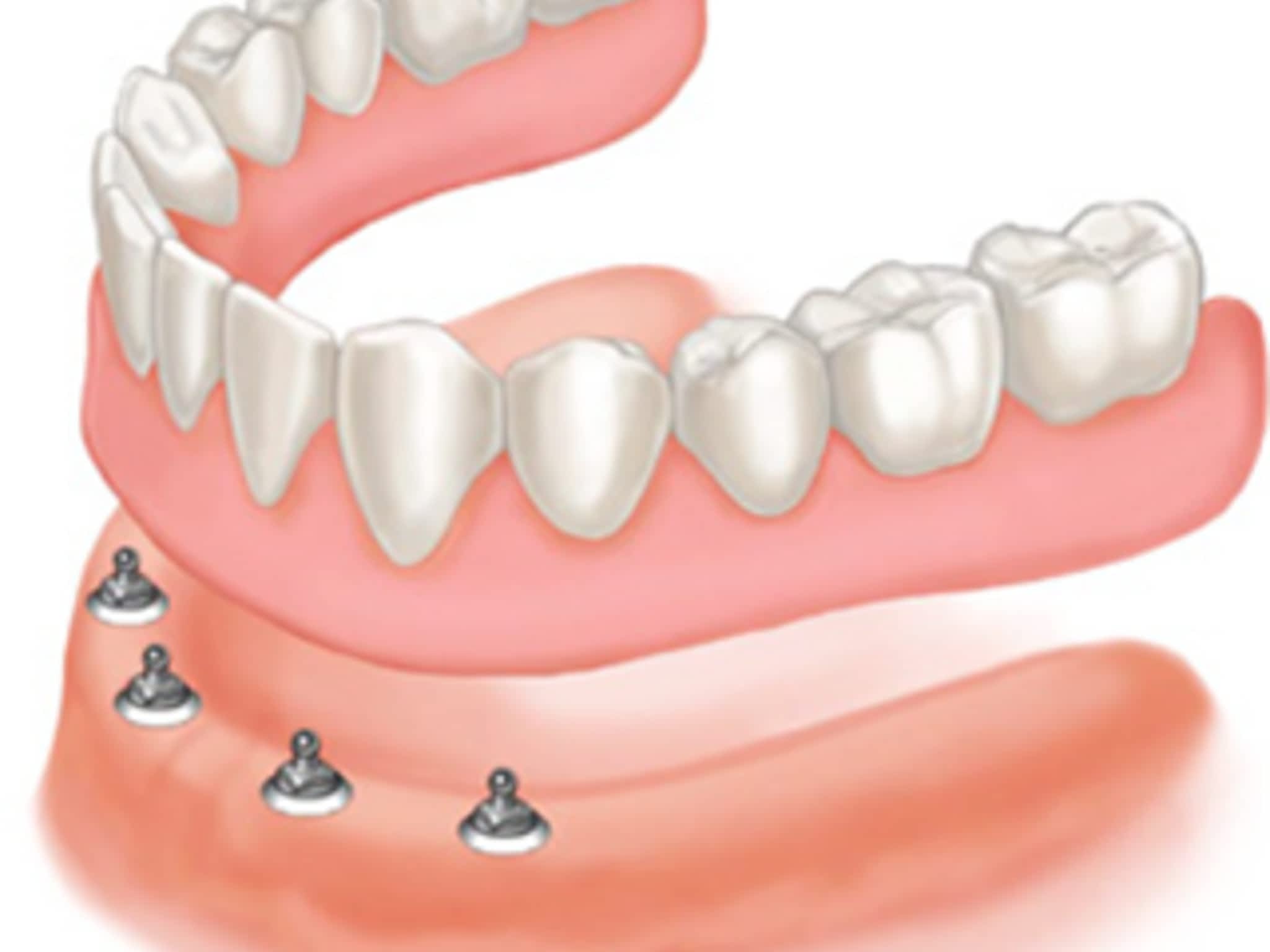 photo Bluewater Denture Clinics