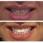 Tooth Corner Markham - Denturologistes