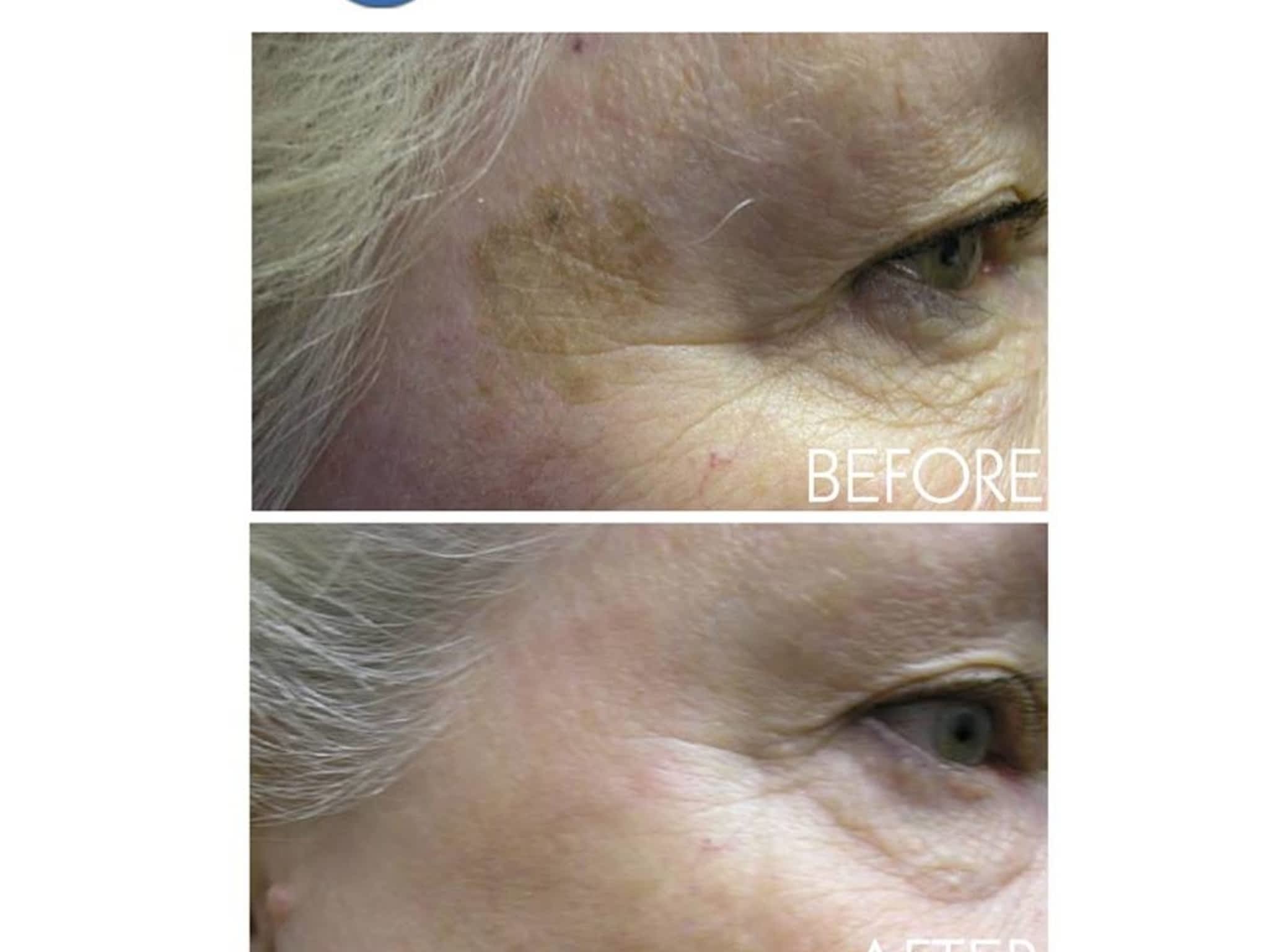 photo Enlighten Laser & Skin Care Clinic Calgary SW