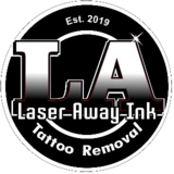 View Laser Away Ink’s Toronto profile