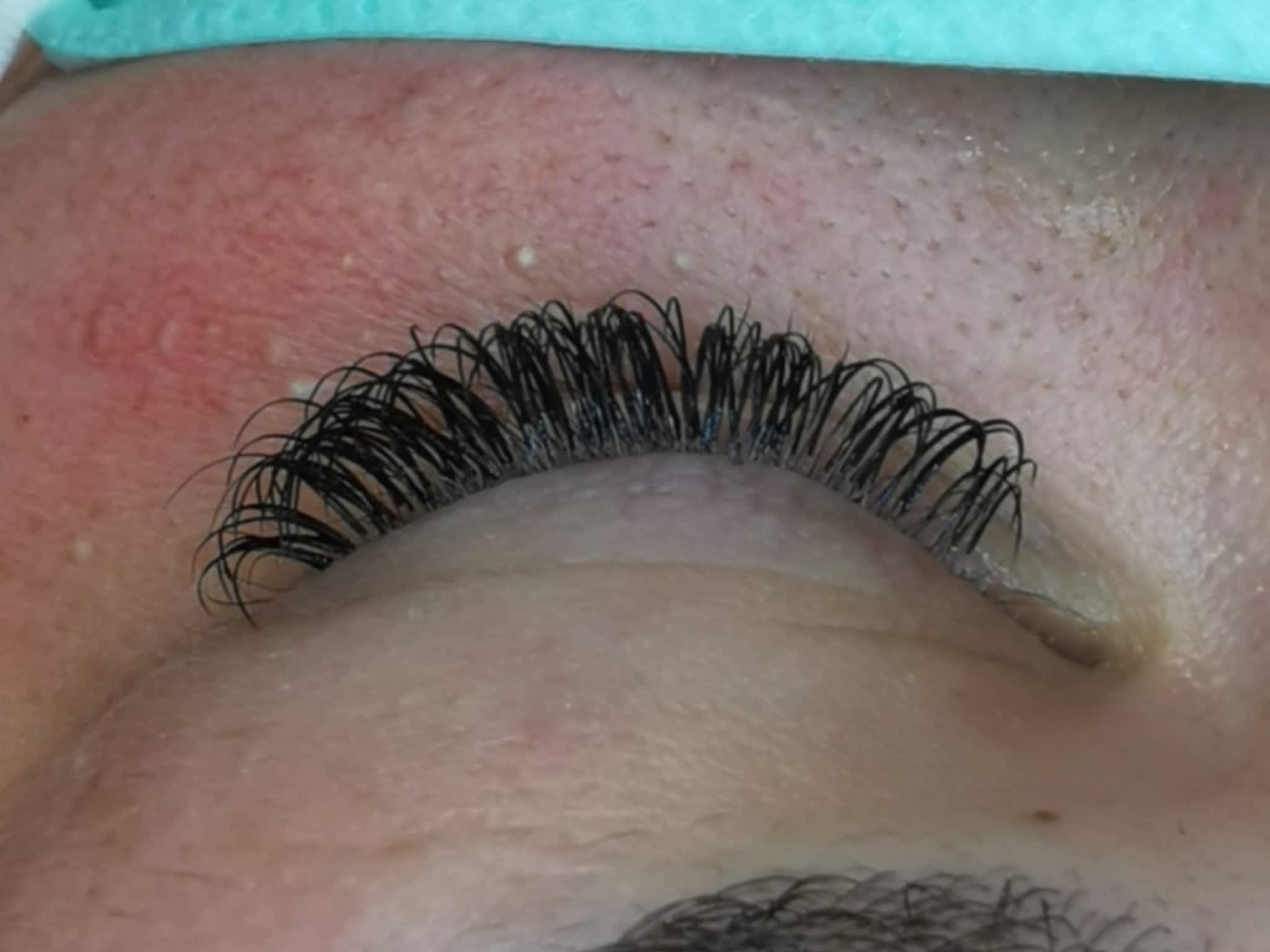 photo SBR Esthétique