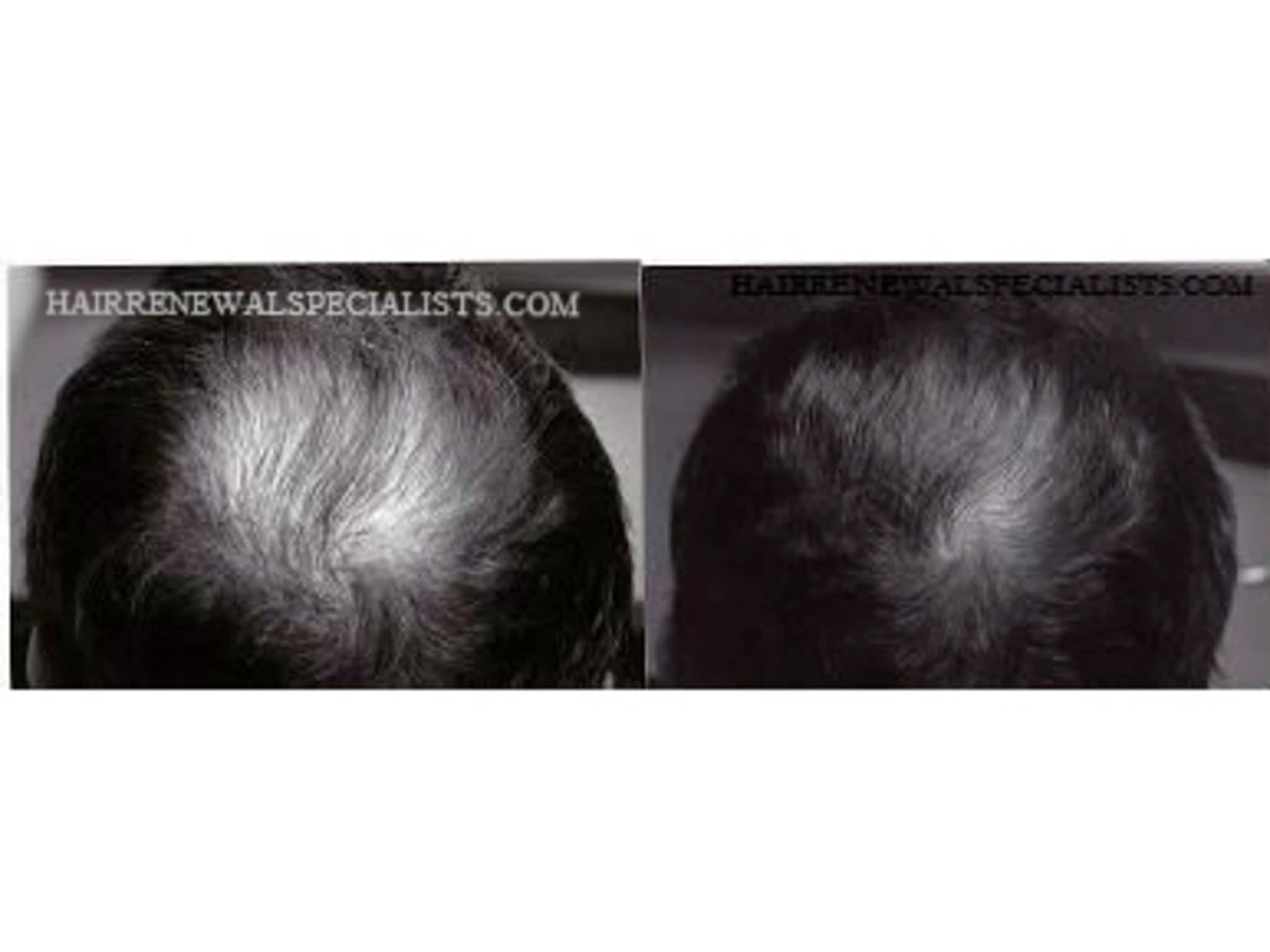 photo Hair Renewal Specialists